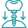 Ícone Dentes Sobre Implantes - Qualidade e segurança em implantes dentários na Clínica Wust em Rolante-RS, tecnologia avançada de scanner intraoral e impressora 3D, guias cirúrgicas personalizadas sem cortes ou pontos, conforto, rapidez e precisão